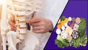 ANKYLOSING SPONDYLITIS