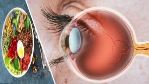 retinopathy