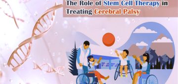 The Role of Stem Cell Therapy in Treating Cerebral Palsy