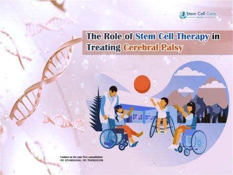 The Role of Stem Cell Therapy in Treating Cerebral Palsy