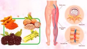 Sciatic Nerve Injury & Sciatica