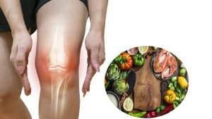 osteoarthiritis