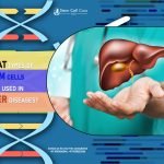 What Types of Stem Cells Are Used in Liver Diseases?