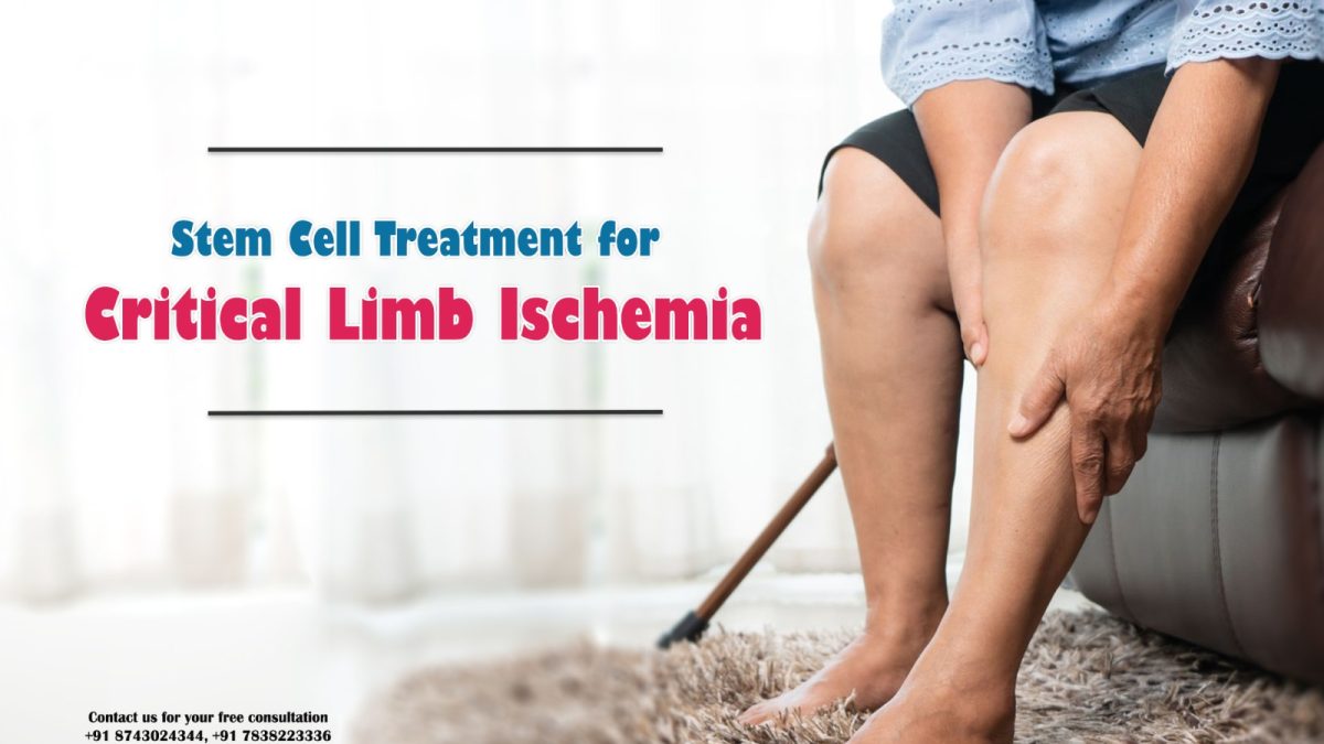 How Stem Cells Work for Treatment of Critical Limb Ischemia?