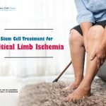 How Stem Cells Work for Treatment of Critical Limb Ischemia?