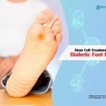 What is The Impact of Stem Cell Treatment on Diabetic Foot Ulcers?