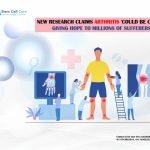 New Research Claims Arthritis βCould Be Curedβ Giving Hope to Millions of Sufferers