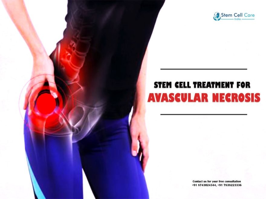 Why Choose Stem Cell Treatment for Avascular Necrosis?
