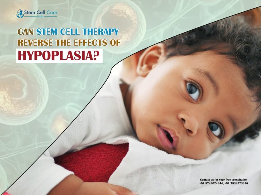 Can Stеm Сеll Therapy Rеvеrsе The Effects of Hypoplasia?