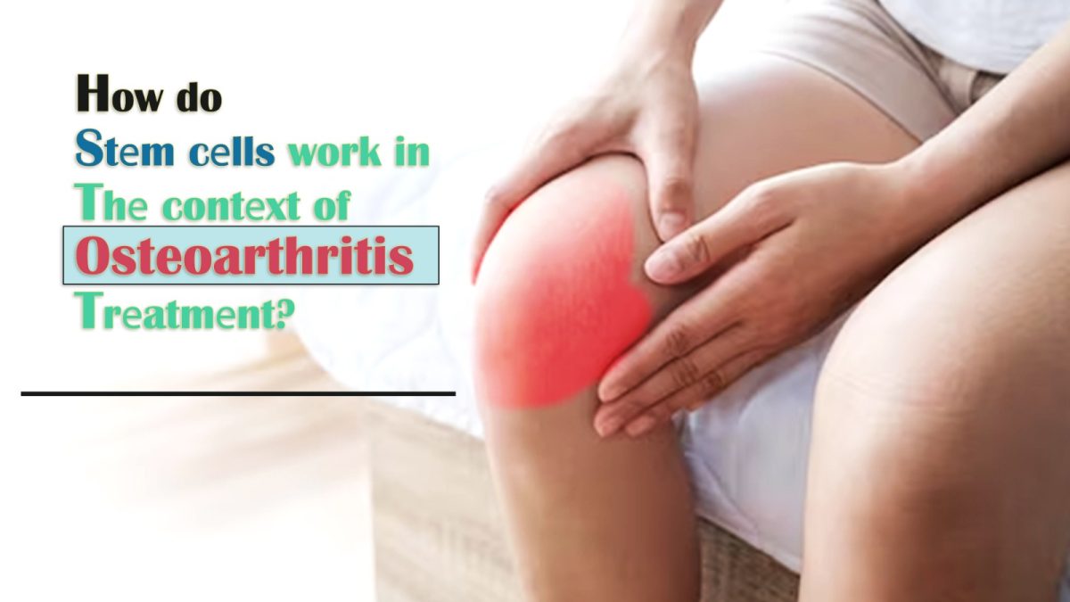 How Do Stеm Cеlls Work in Thе Contеxt of Osteoarthritis Trеatmеnt?