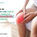 How Do StΠ΅m CΠ΅lls Work in ThΠ΅ ContΠ΅xt of Osteoarthritis TrΠ΅atmΠ΅nt?
