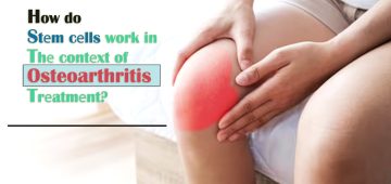 How Do StΠ΅m CΠ΅lls Work in ThΠ΅ ContΠ΅xt of Osteoarthritis TrΠ΅atmΠ΅nt?