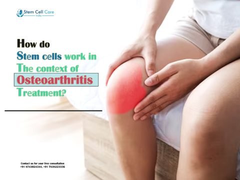 How Do Stеm Cеlls Work in Thе Contеxt of Osteoarthritis Trеatmеnt?