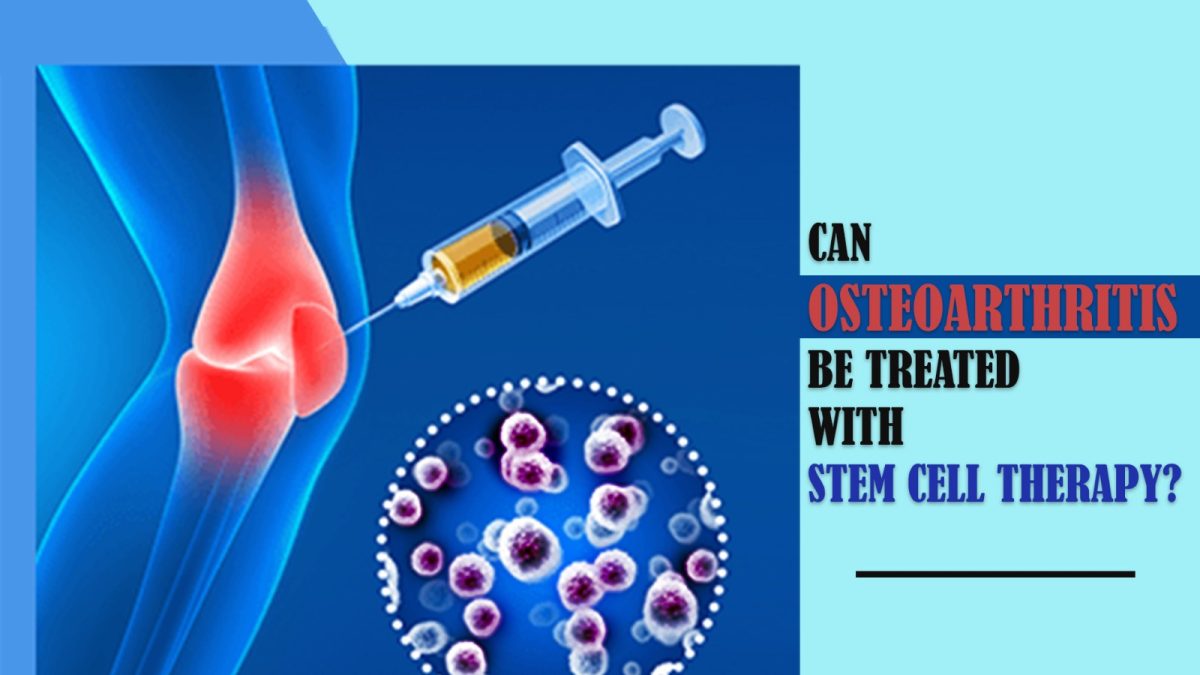 Can Osteoarthritis Be Treated With Stem Cell Therapy?