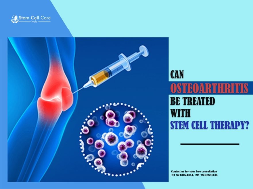 Can Osteoarthritis Be Treated With Stem Cell Therapy?
