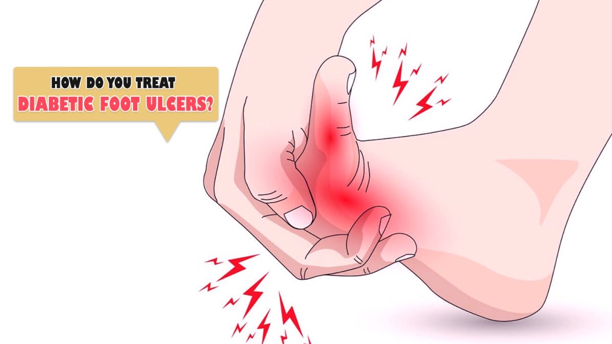How Do You Treat Diabetic Foot Ulcers?