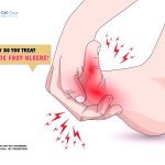 How Do You Treat Diabetic Foot Ulcers?