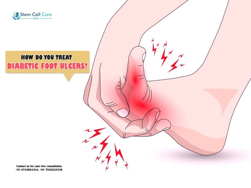 How Do You Treat Diabetic Foot Ulcers?