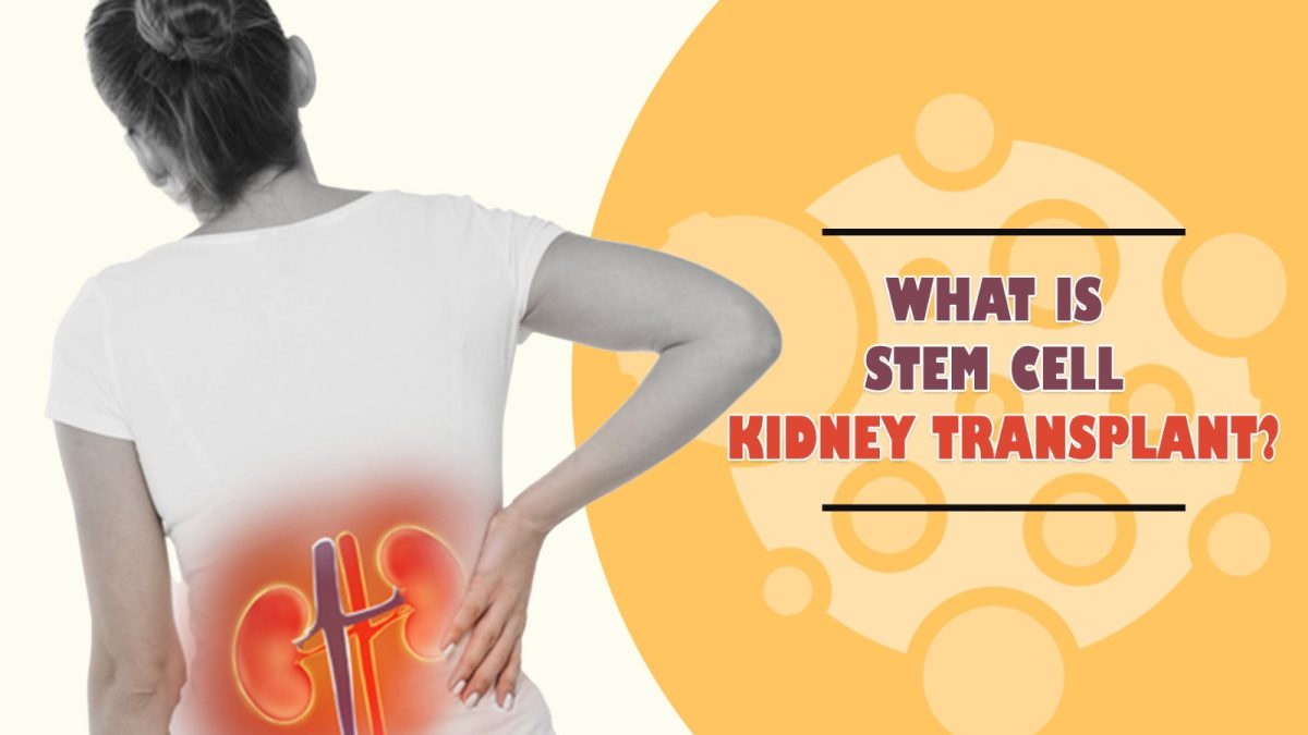 What Is Stem Cell Kidney Transplant?
