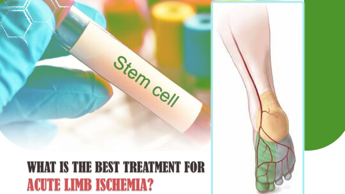 What Is the Best Treatment for Acute Limb Ischemia?
