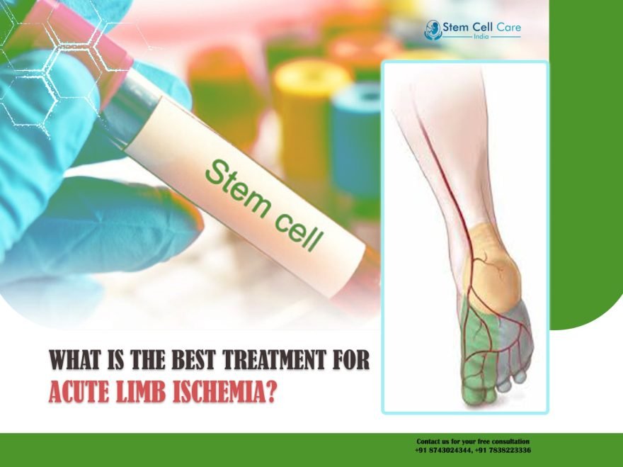 What Is the Best Treatment for Acute Limb Ischemia?