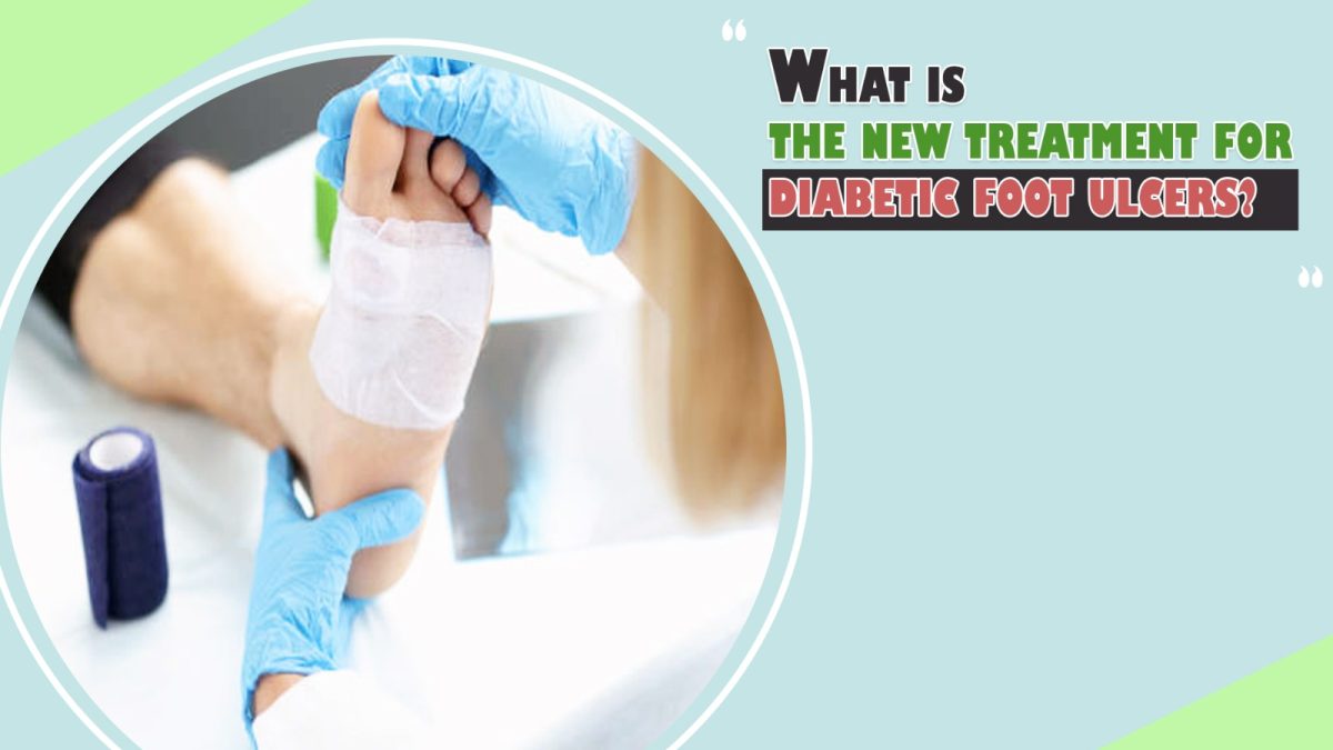 What Is the New Treatment for Diabetic Foot Ulcers?