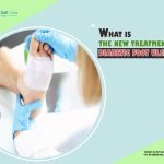 What Is the New Treatment for Diabetic Foot Ulcers?