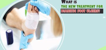 What Is the New Treatment for Diabetic Foot Ulcers?