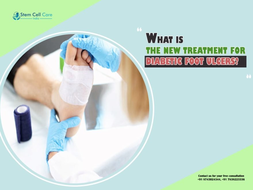 What Is the New Treatment for Diabetic Foot Ulcers?