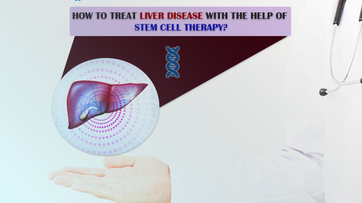 How to Treat Liver Disease with the Help of Stem Cell Therapy?