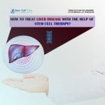 How to Treat Liver Disease with the Help of Stem Cell Therapy?
