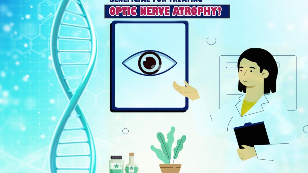 Which Stem Cell is Beneficial for Treating Optic Nerve Atrophy?