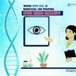 Which Stem Cell is Beneficial for Treating Optic Nerve Atrophy?