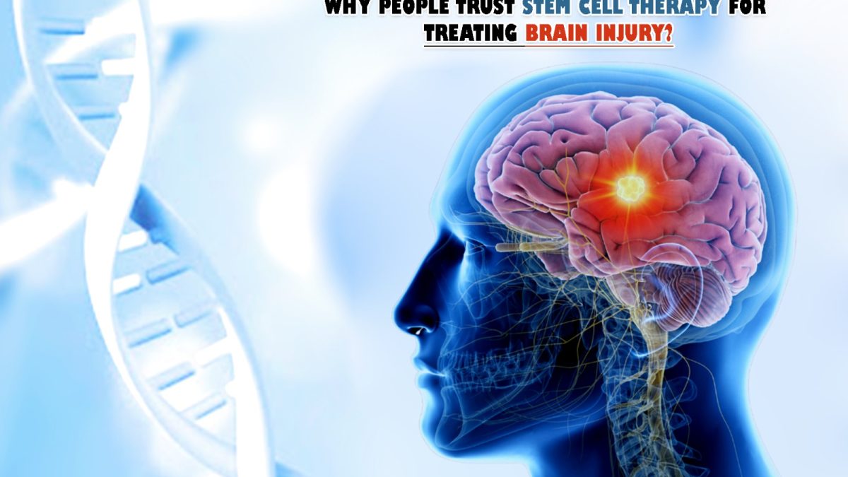 Why People Trust Stem Cell Therapy for Treating Brain Injury?