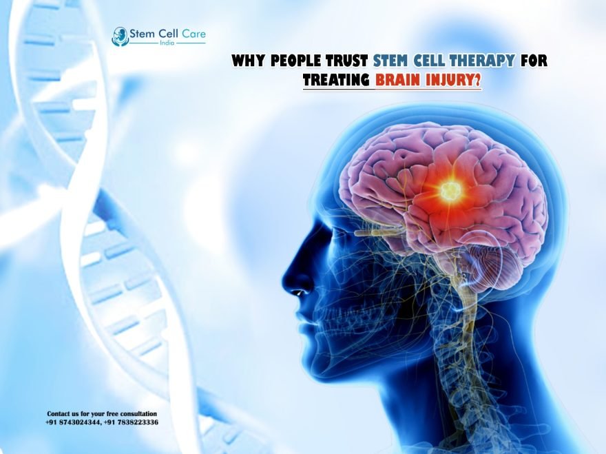 Why People Trust Stem Cell Therapy for Treating Brain Injury?