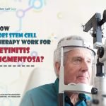How Does Stem Cell Therapy Work for Retinitis Pigmentosa?