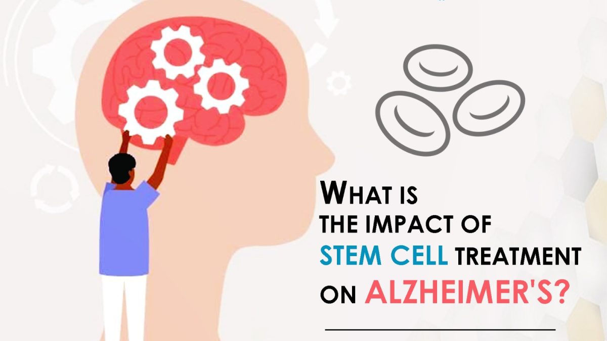 What Is the Impact of Stem Cell Treatment on Alzheimer’s?