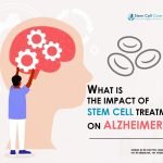 What Is the Impact of Stem Cell Treatment on Alzheimerβs?