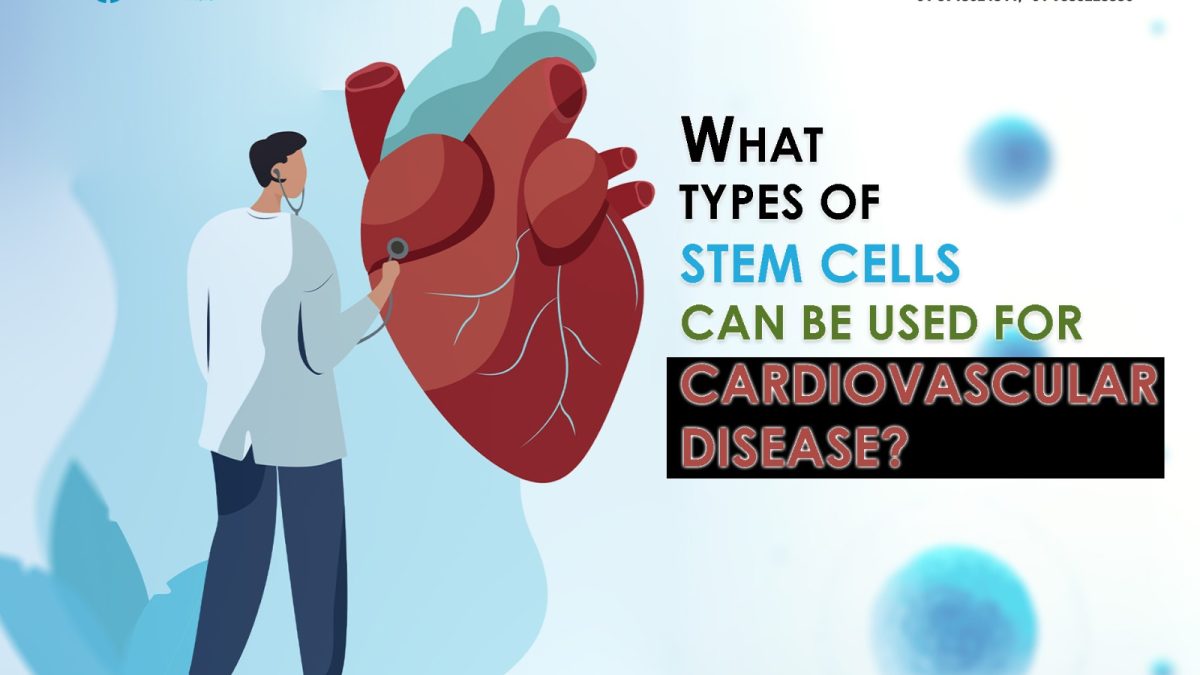 What Types of Stem Cells Can Be Used for Cardiovascular Disease?