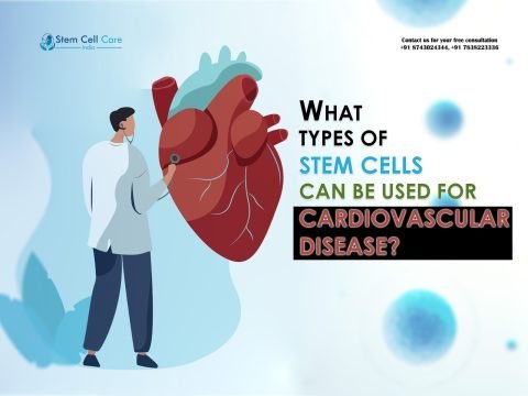 What Types of Stem Cells Can Be Used for Cardiovascular Disease?