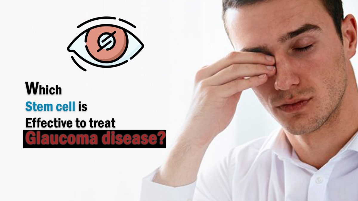 Which Stem Cell Is Effective to Treat Glaucoma Disease?