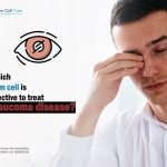 Which Stem Cell Is Effective to Treat Glaucoma Disease?