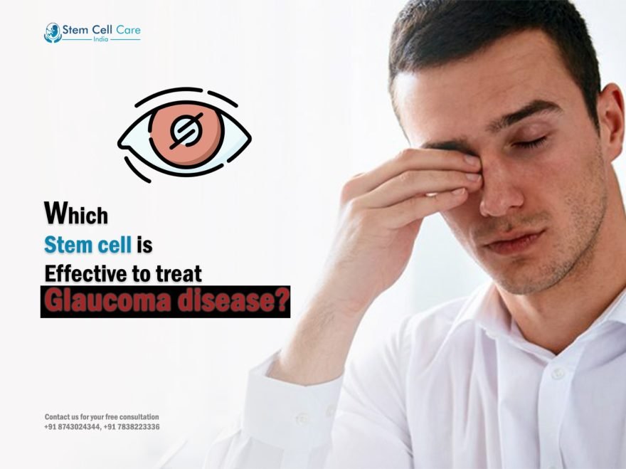 Which Stem Cell Is Effective to Treat Glaucoma Disease?