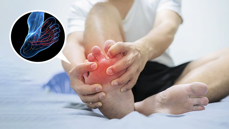 Exosome Treatment For Neuropathy Exosome Treatment For Neuropathy