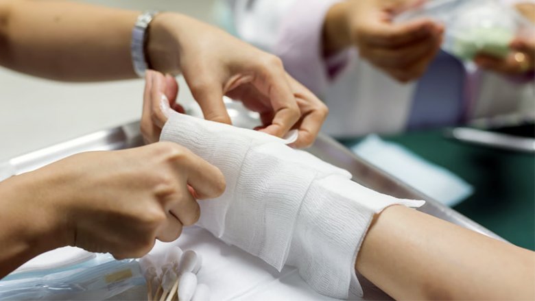 Exosome Treatment for Major Skin Abrasions