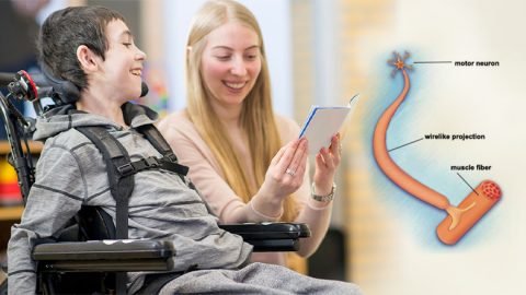 Exosome Treatment for Spinal Muscular Atrophy