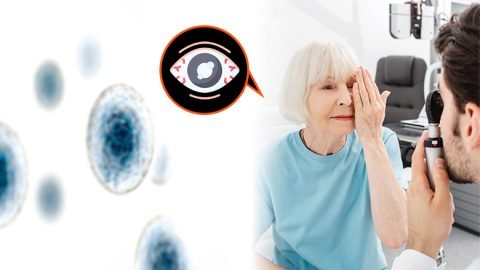Exosome Treatment For Glaucoma Disease