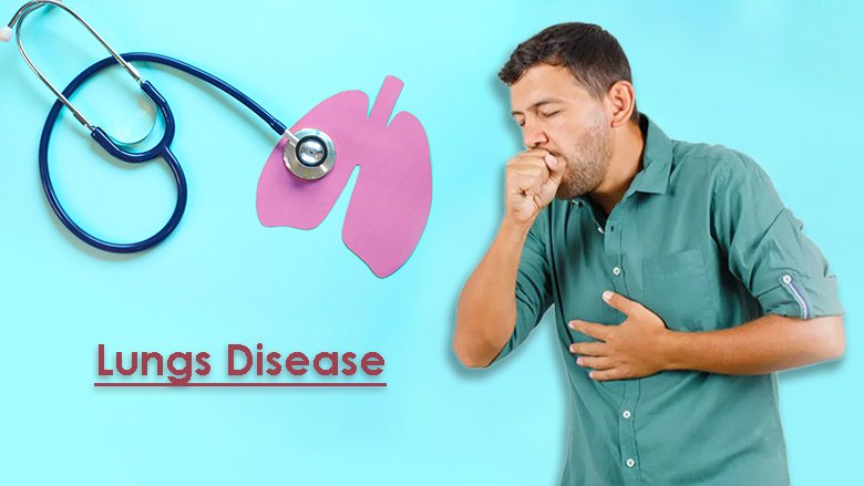 Exosome Treatment For Lungs Disease