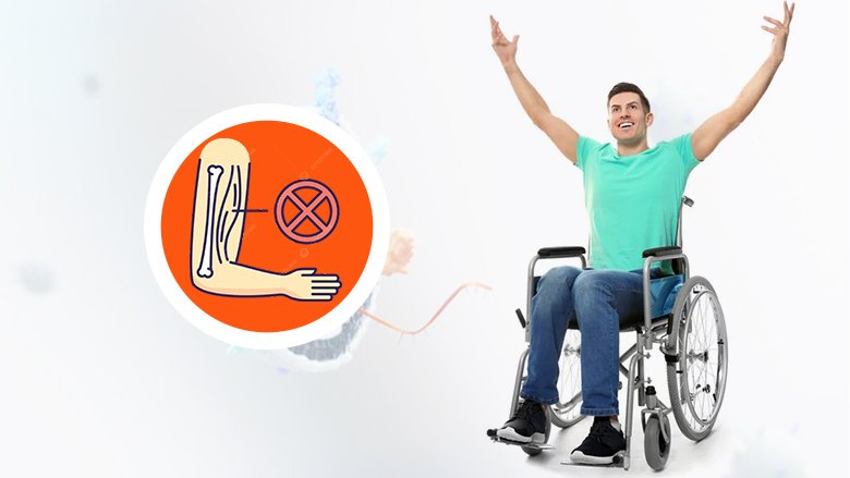 Exosome Treatment For Muscular Dystrophy