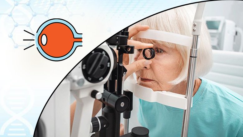 Optic Nerve Atrophy Exosome Treatment For Optic Nerve Atrophy